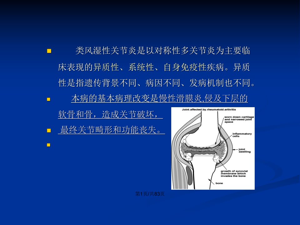 内科学类风湿性关节炎