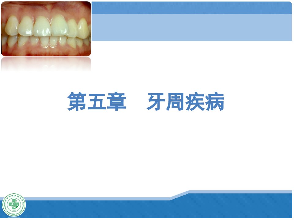 口腔科学-第五章-牙周疾病