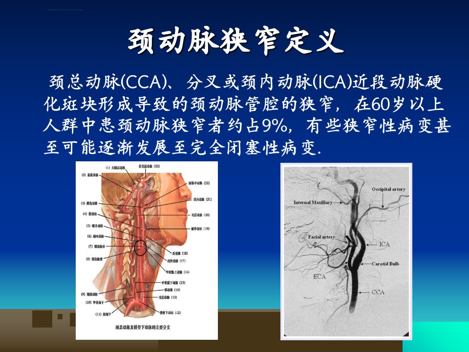 颈动脉狭窄支架介入治疗ppt课件