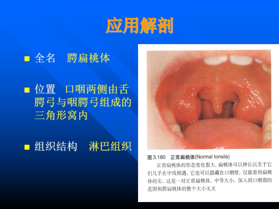 扁桃体讲课