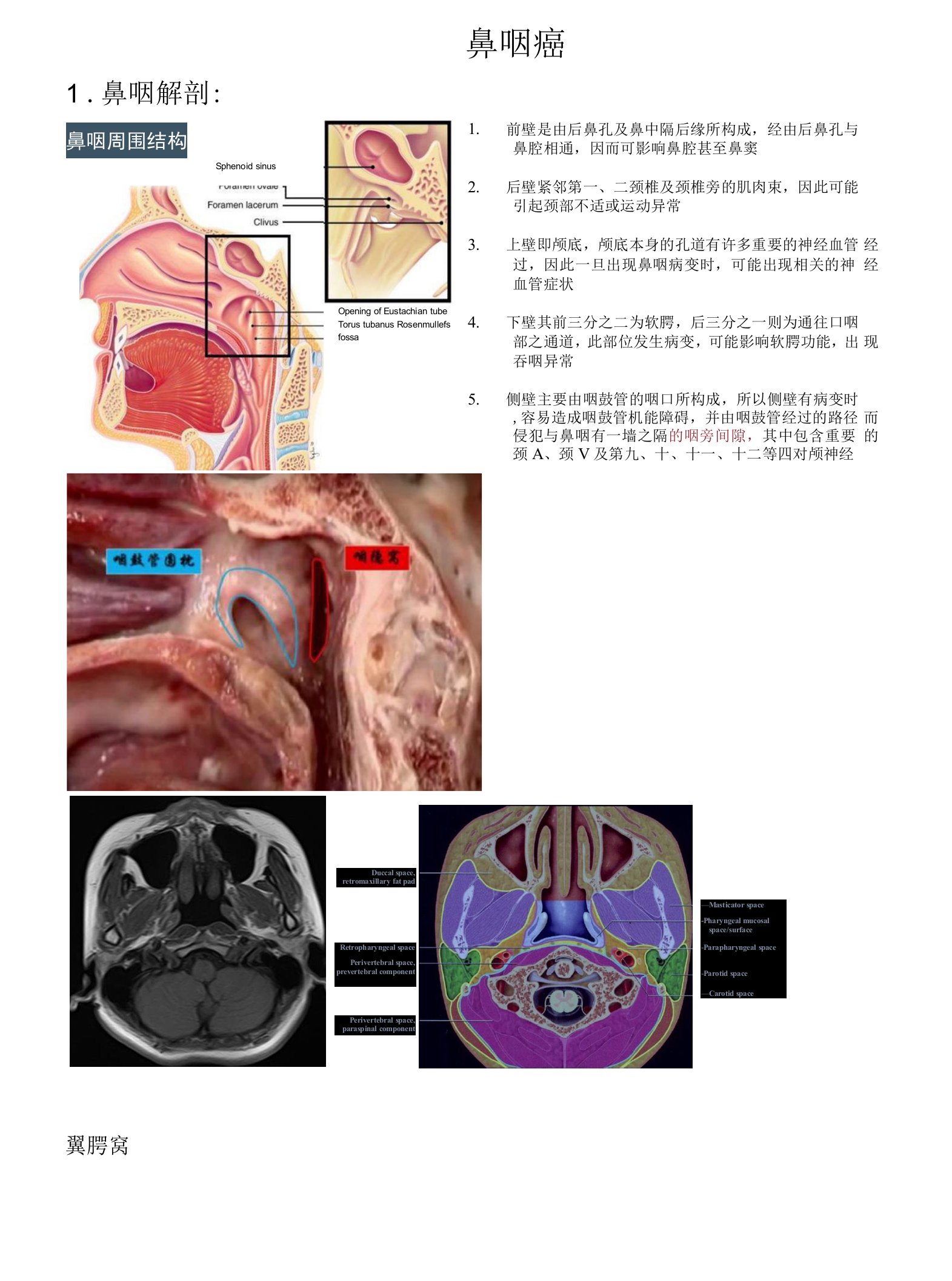 鼻咽癌影像学诊断