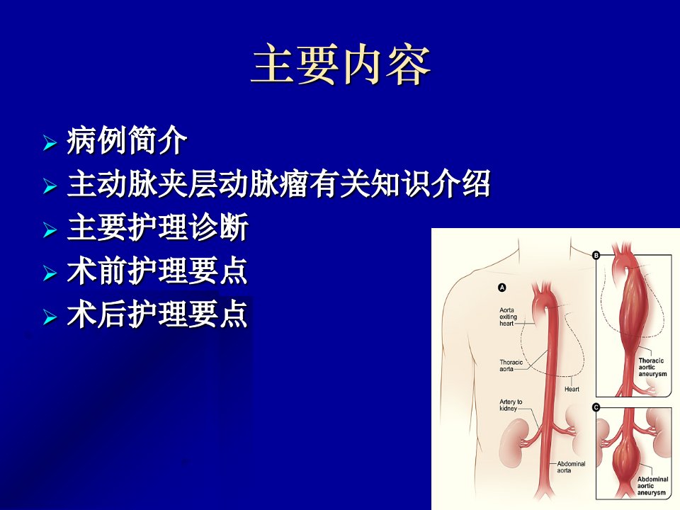 主动脉夹层动脉瘤围手术期教学查房