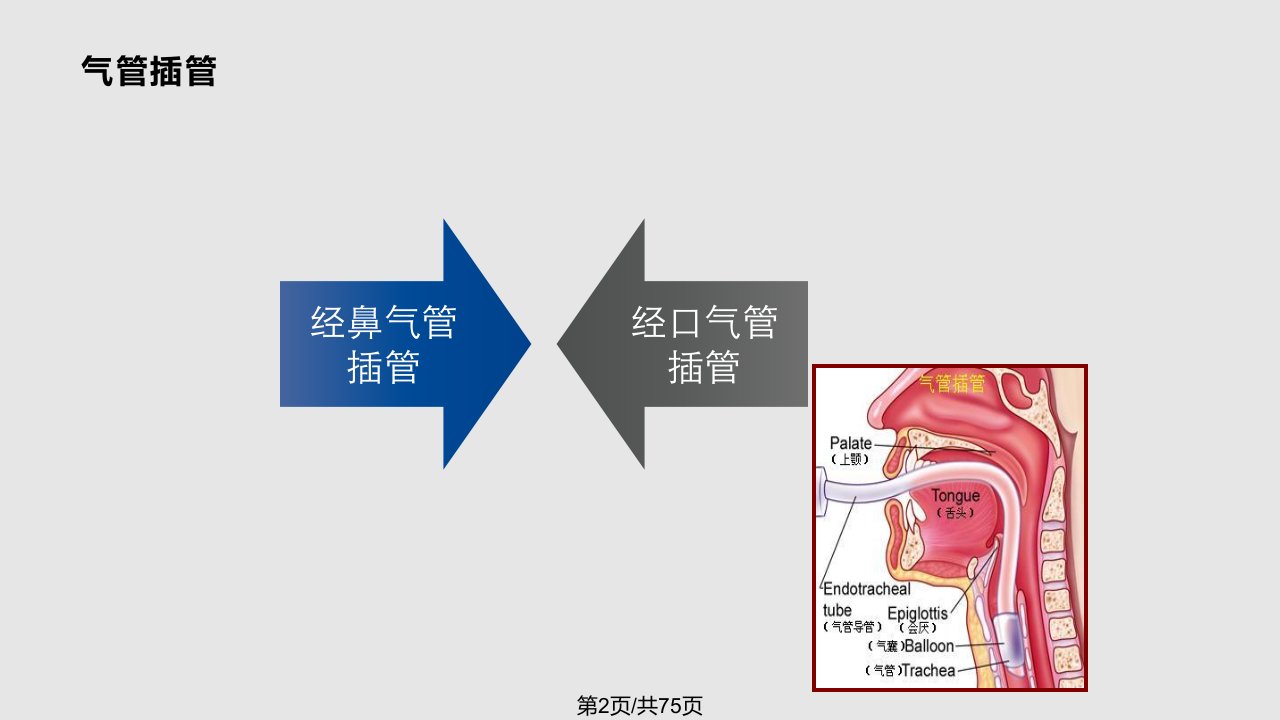 气管插管和气道湿化