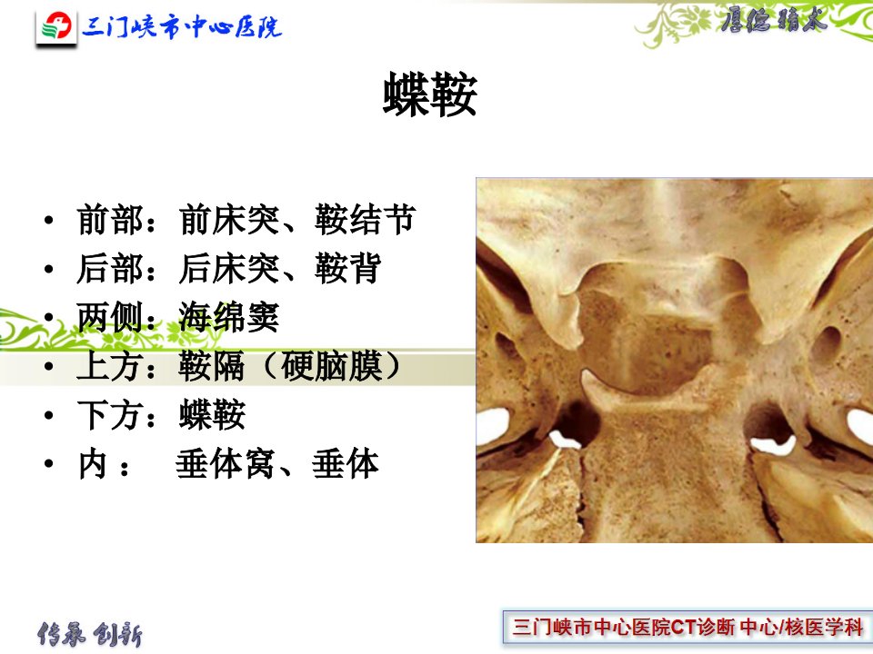 垂体解剖及垂体瘤