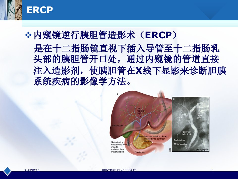 ERCP诊疗和并发症培训ppt课件