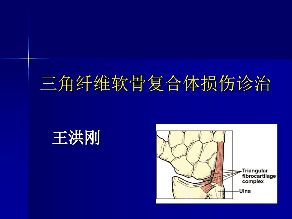 三角纤维软骨复合体损伤诊治