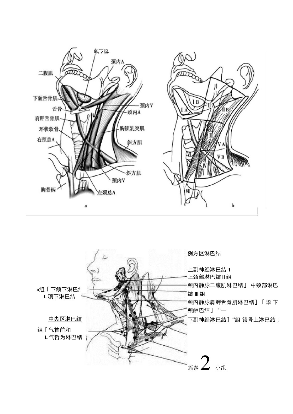 甲状腺淋巴结分区示意图