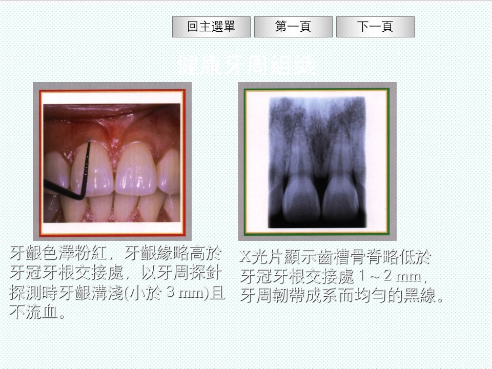 组织设计-健康牙周组织