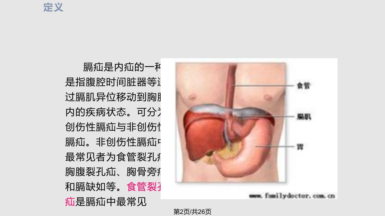 膈疝护理查房