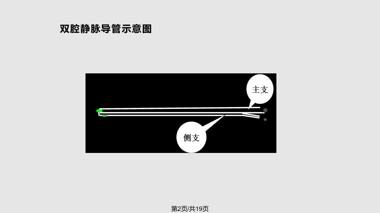 中心静脉拔管指征及并发症