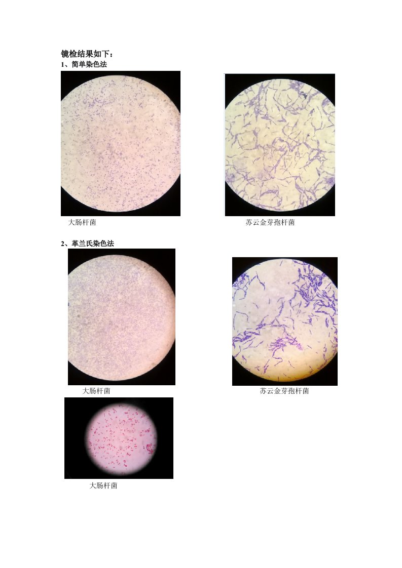 大肠杆菌苏云金芽孢杆菌镜检结果如下