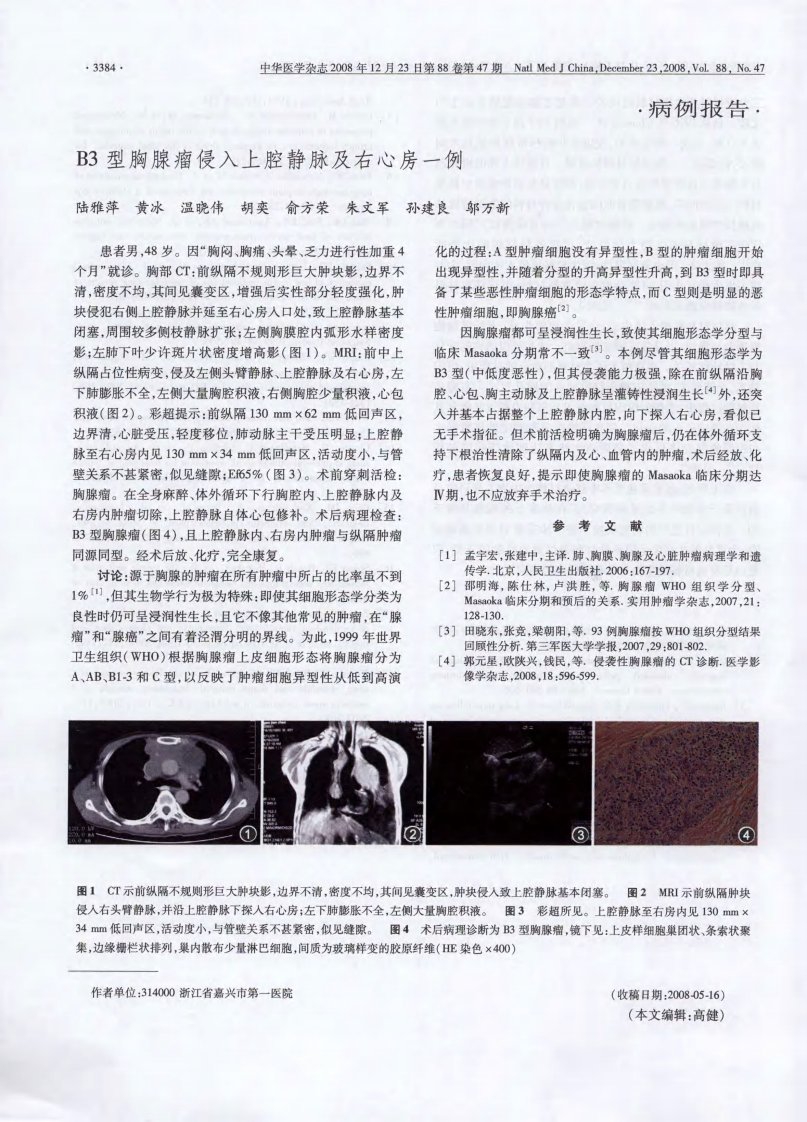 B3型胸腺瘤侵入上腔静脉及右心房一例.pdf