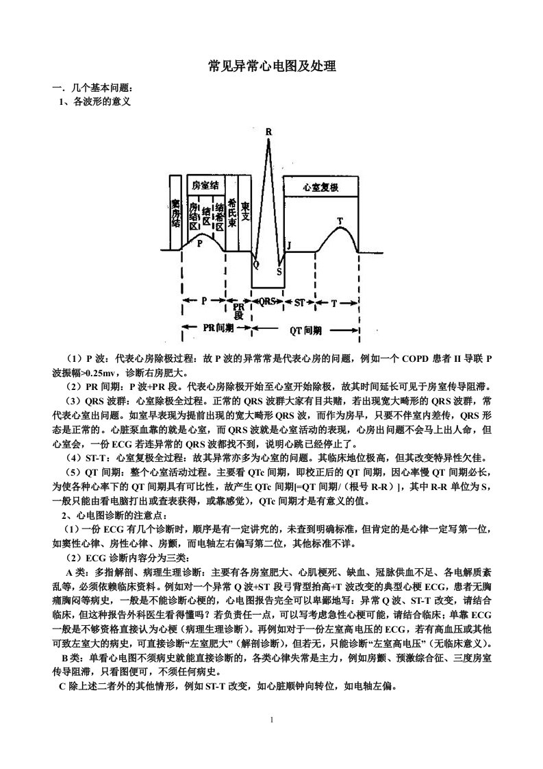 常见异常心电图及处理