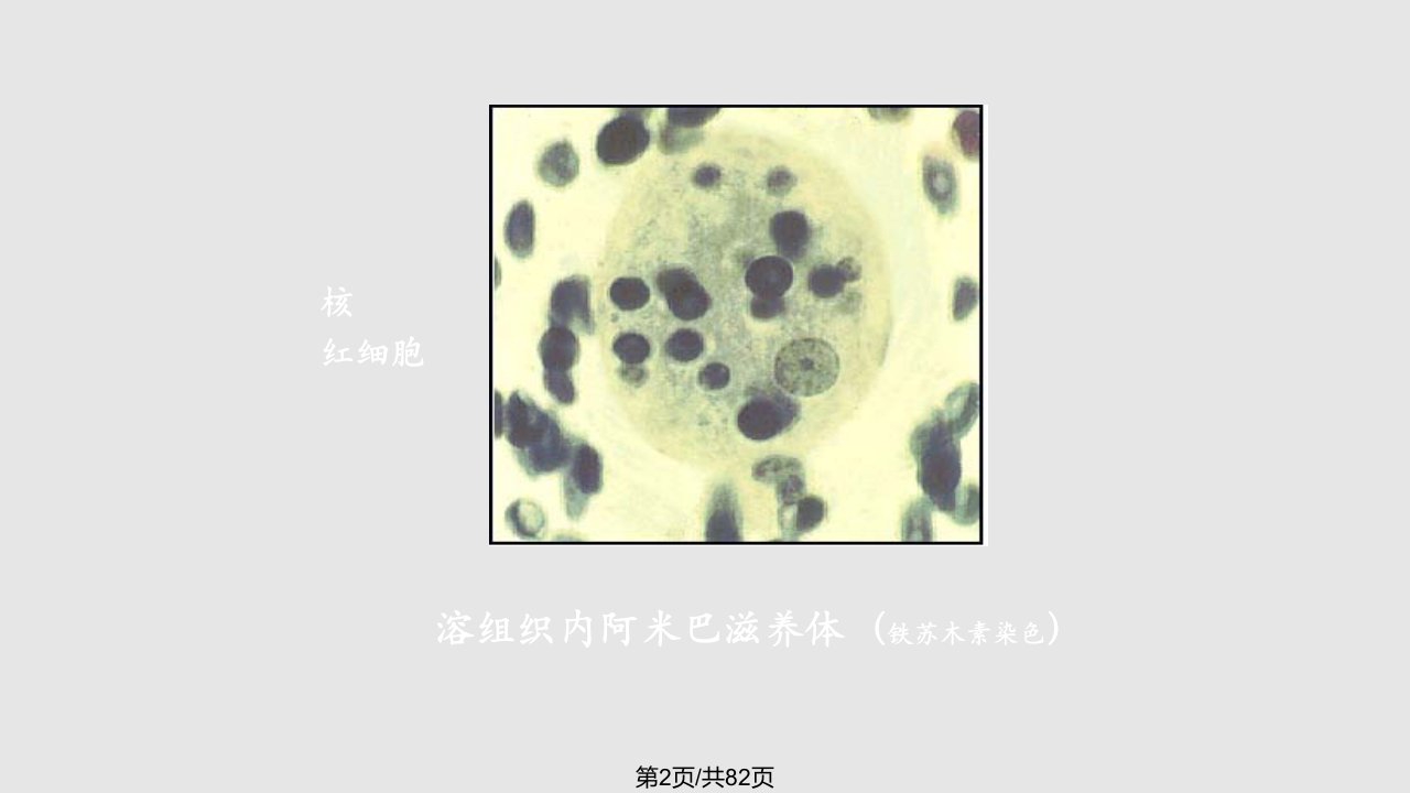 寄生虫实验考图片解说课件