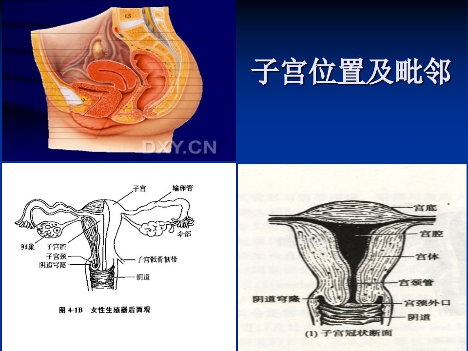 妇科常见疾病的超声检查PPT课件