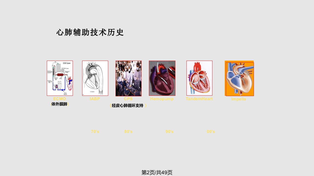 IABP原理及适应症