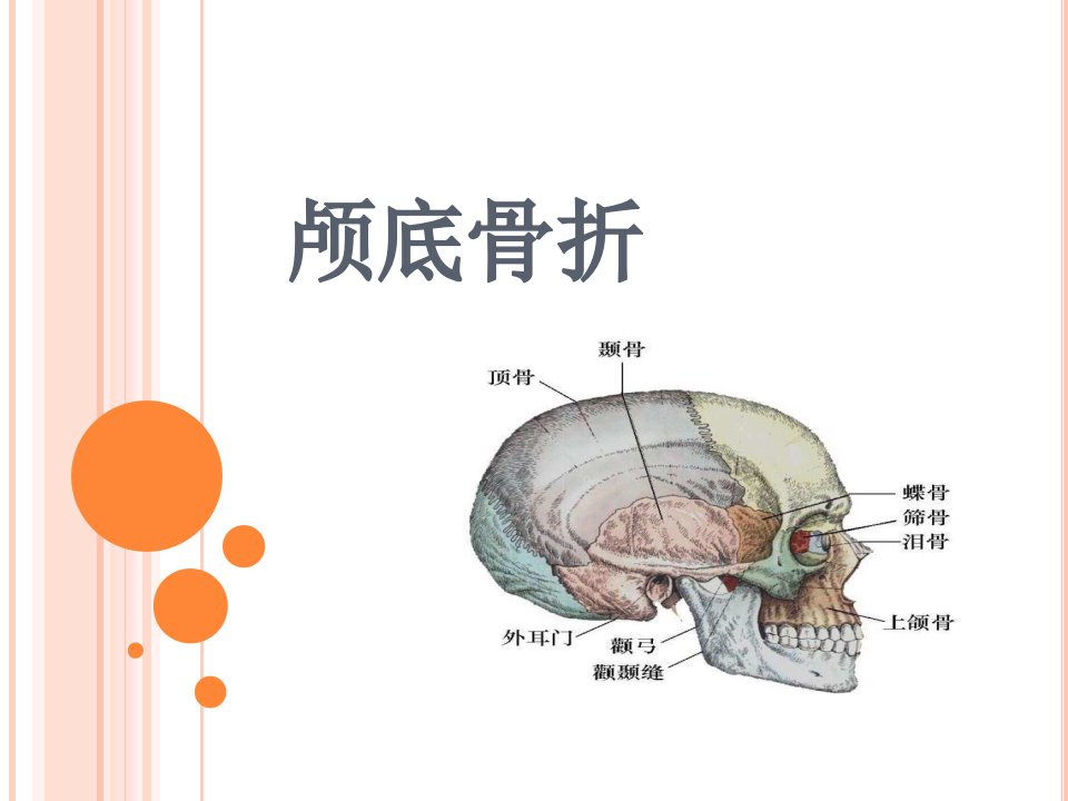 颅底骨折护理标准