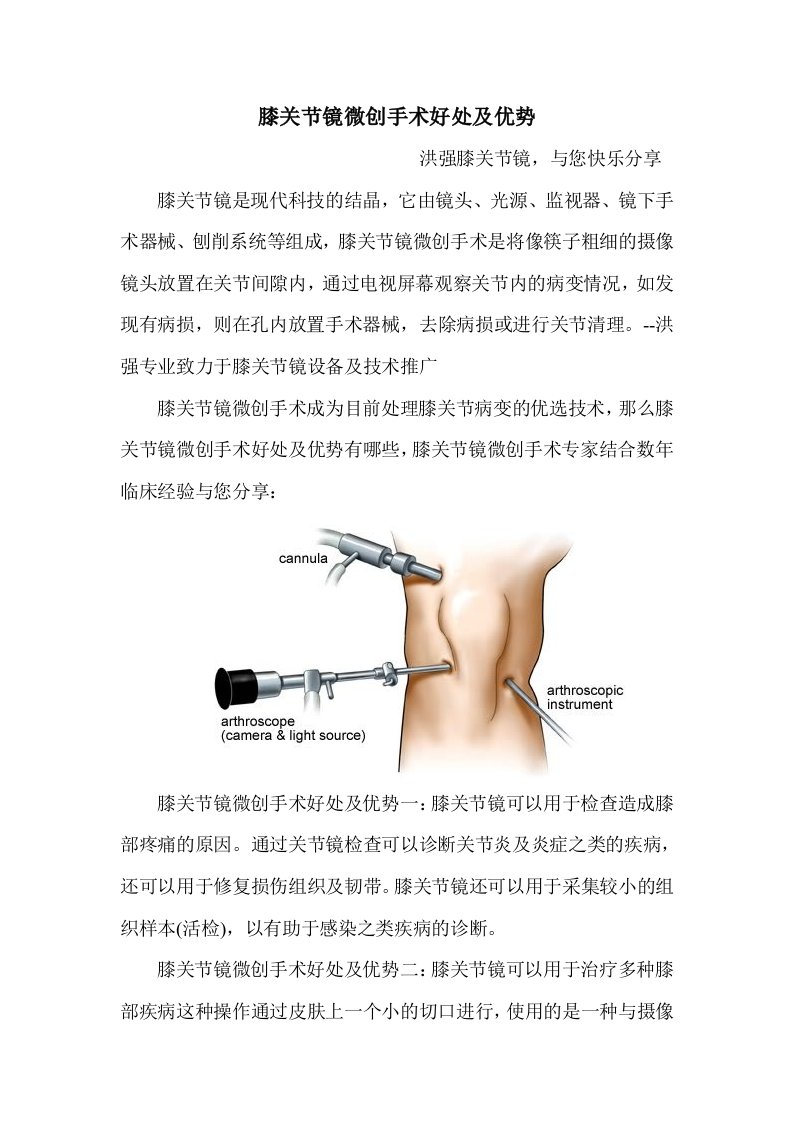 膝关节镜微创手术好处