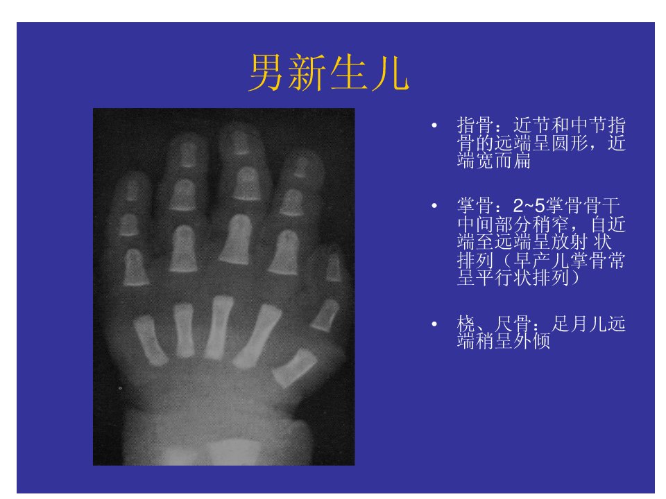 儿童骨龄对照图表