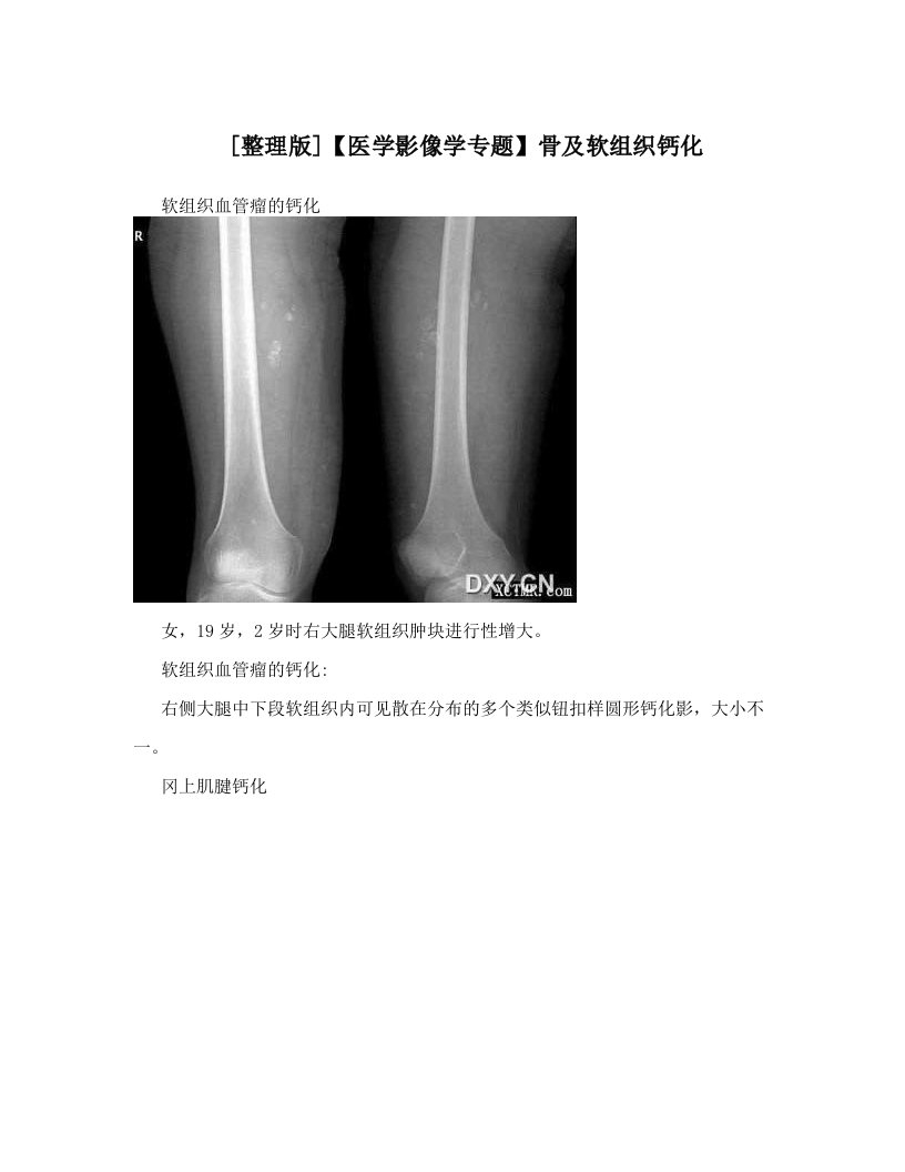 [整理版]【医学影像学专题】骨及软组织钙化