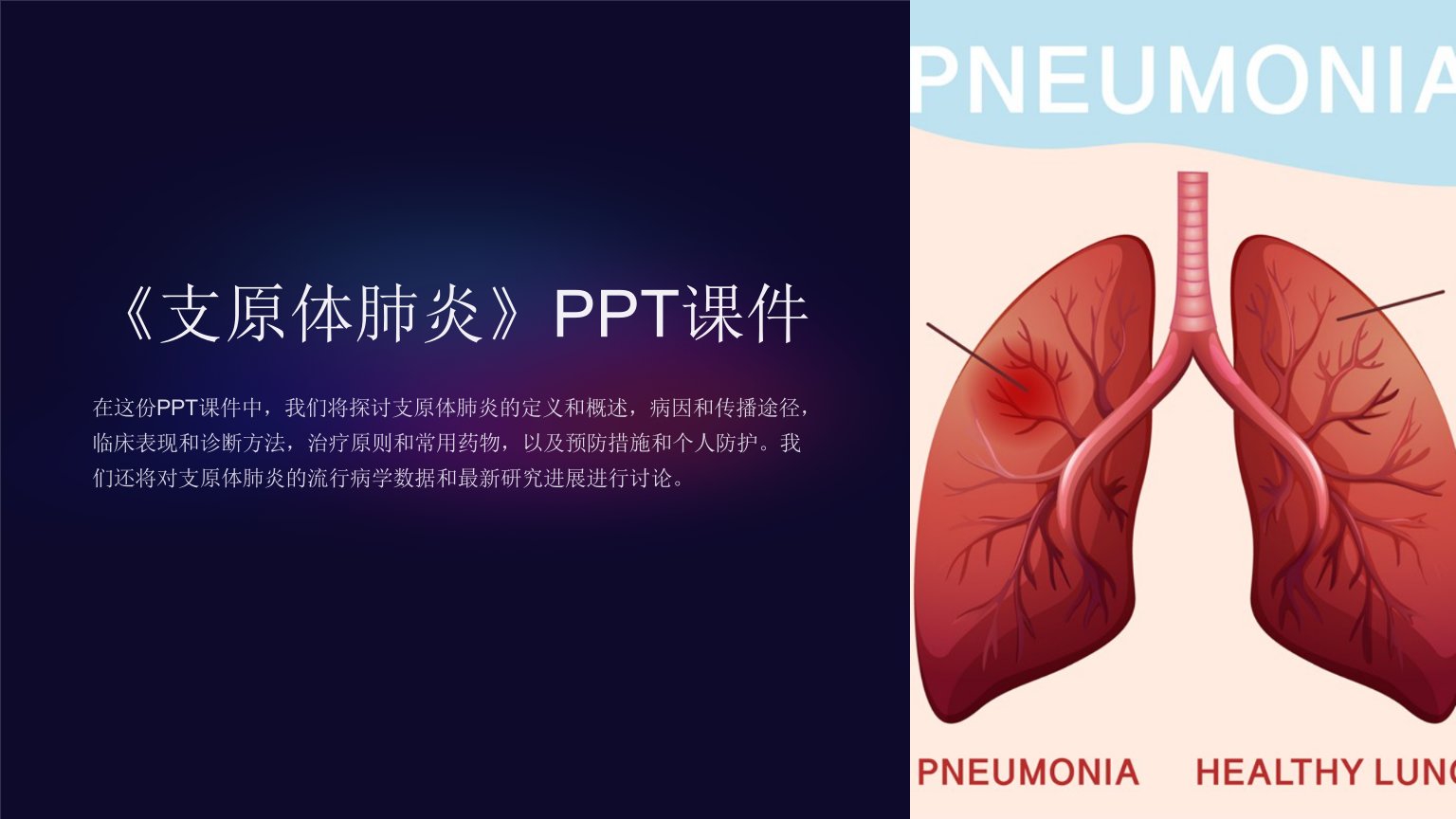 《支原体肺炎》课件