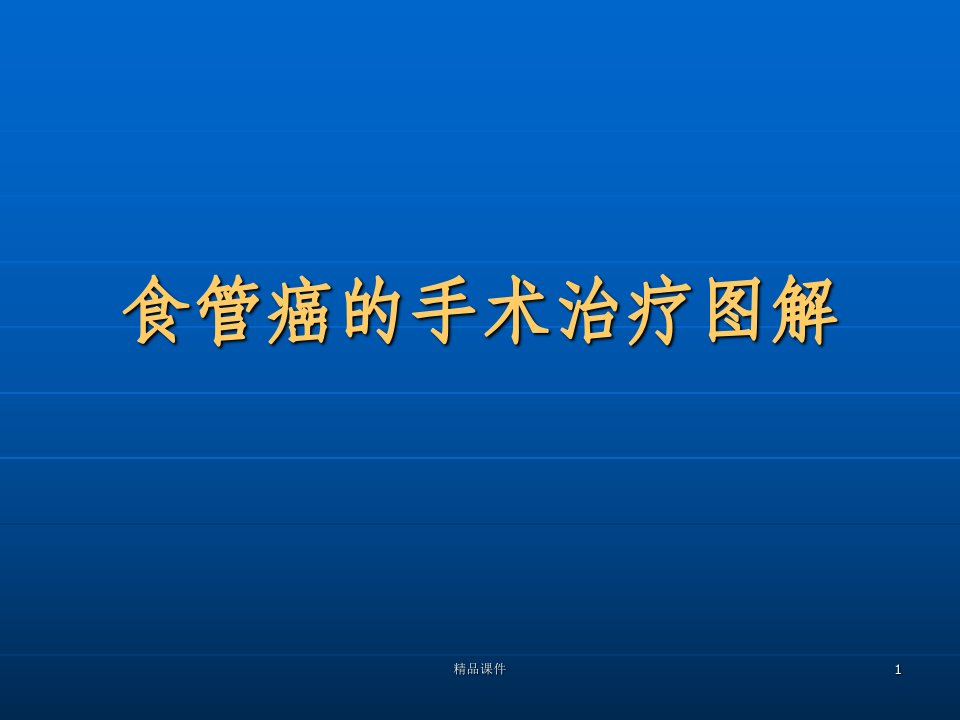 食管癌的手术治疗图解