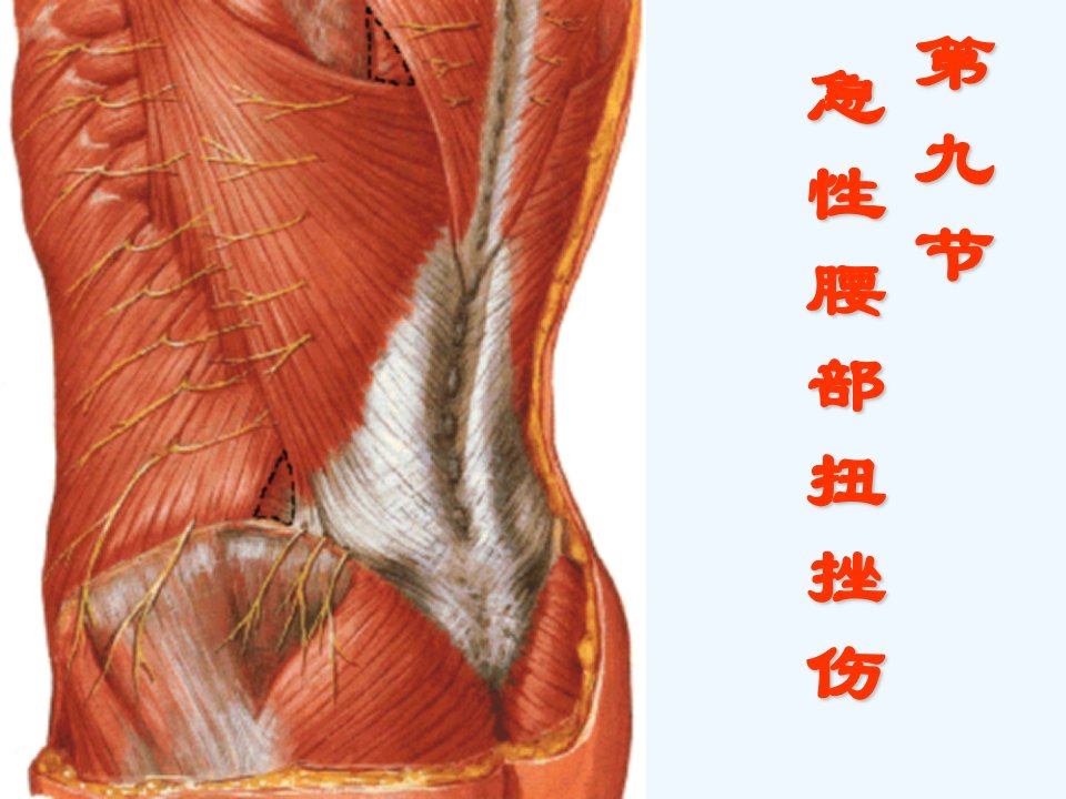 急性腰部扭挫伤