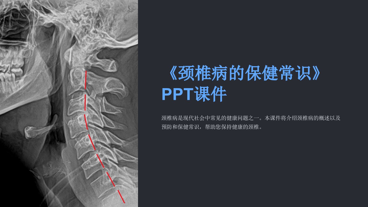 《颈椎病的保健常识》课件