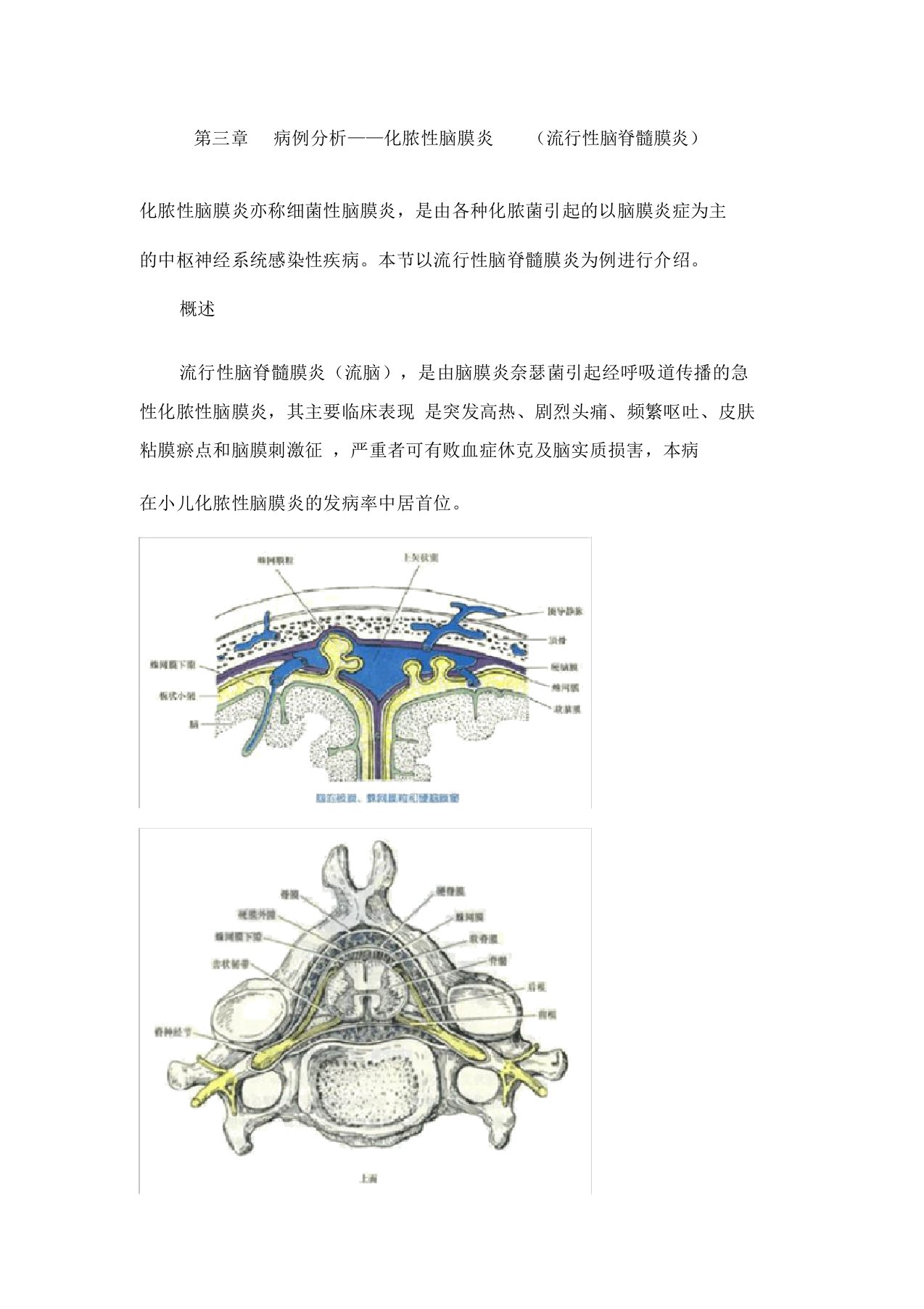 第三章病例分析——化脓性脑膜炎流行性脑脊髓膜炎执业医师实践技能强化精讲课程讲义知识讲解