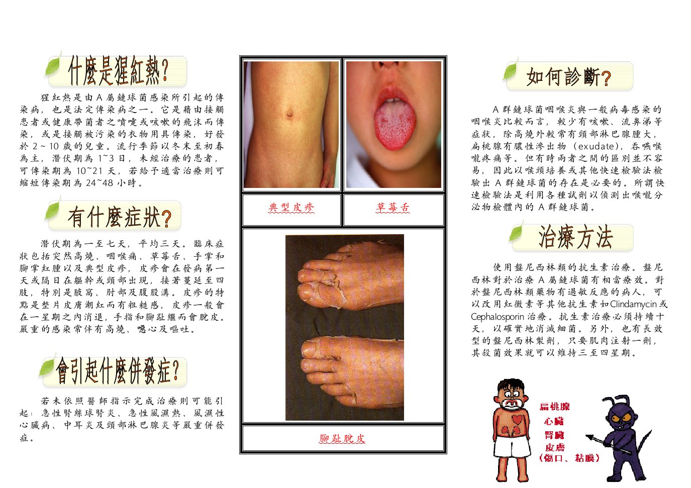 猩红热是由A属链球菌感染所引起的传染病