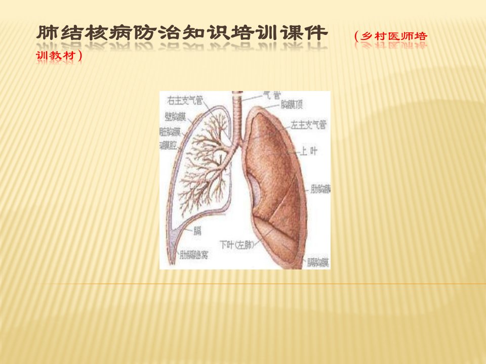 肺结核病防治知识培训课件