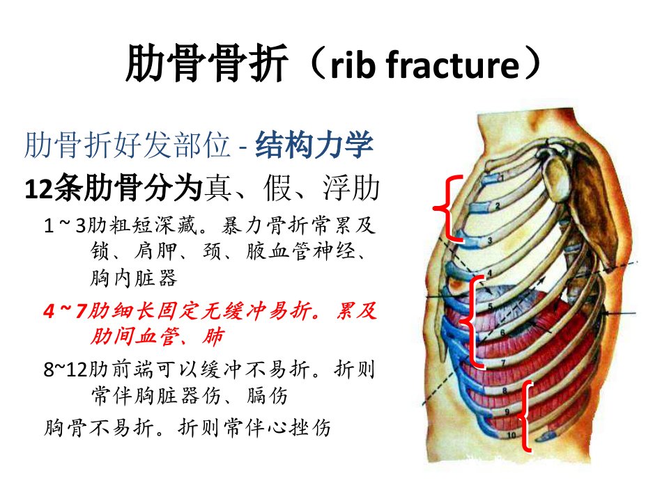 肋骨骨折课件