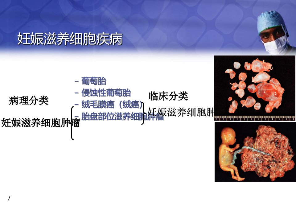 妊娠滋养细胞疾病讲解课件