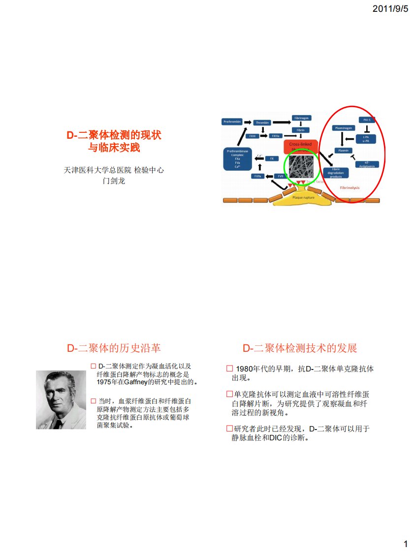 D-二聚体检测现状临床实践(门剑龙)