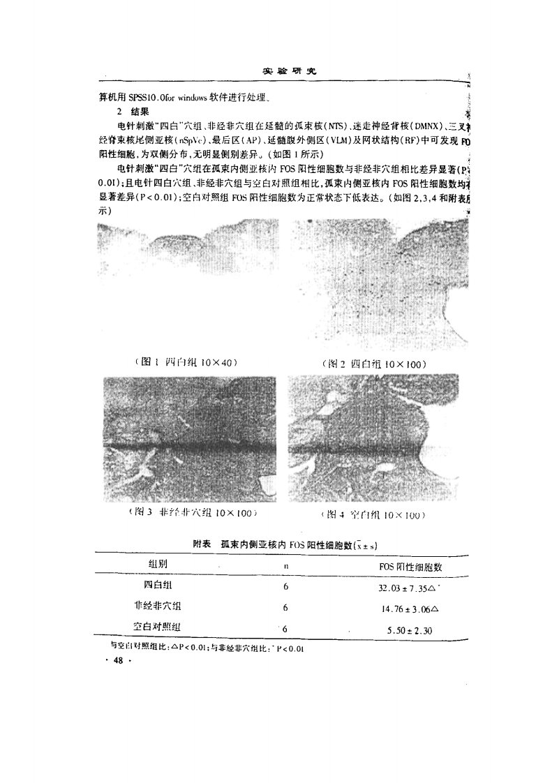 电针四白穴诱导大鼠孤束核c-fos表达的研究