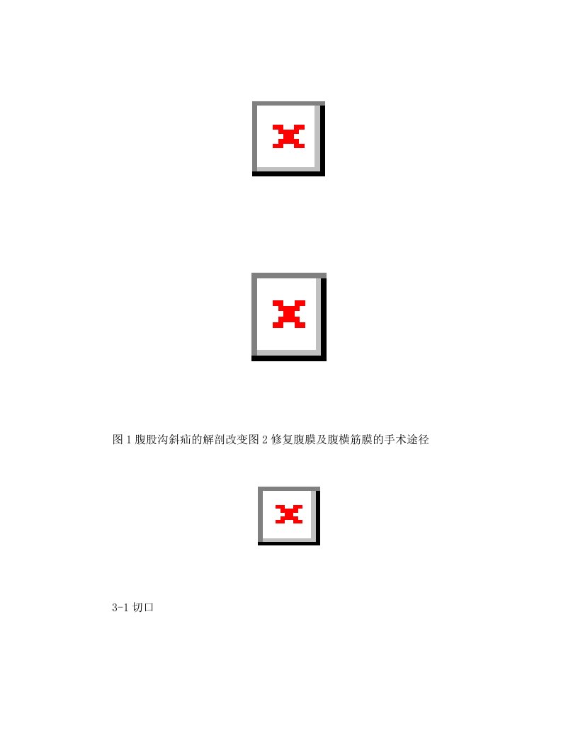 腹股沟斜疝的修补及术式解剖层次