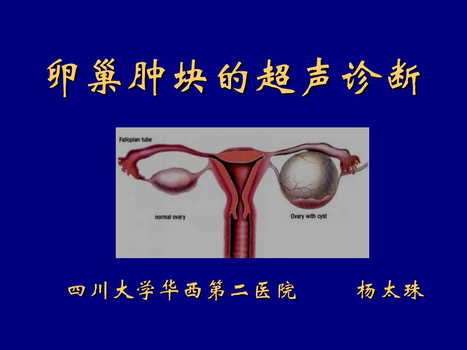 卵巢肿块的超声诊断杨太珠华西