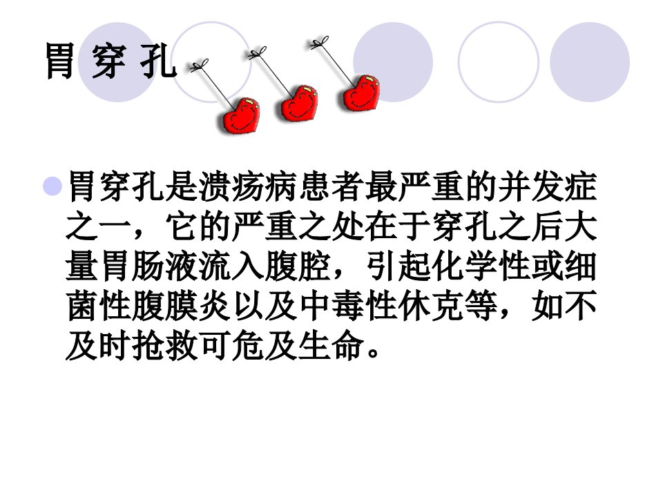 胃穿孔的护理ppt课件