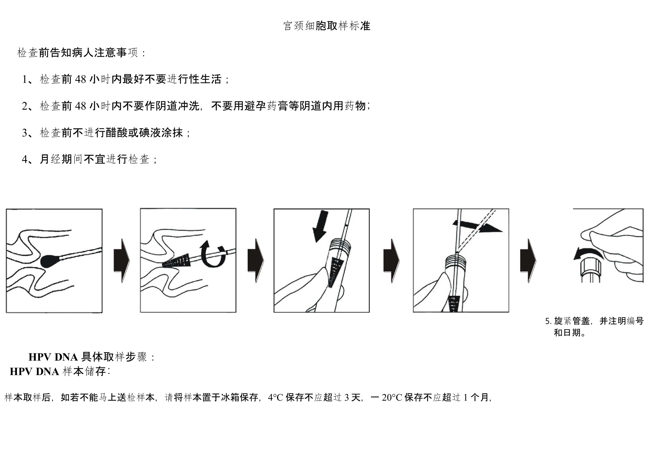 SOP-HPV项目宫颈细胞取样标准操作规程