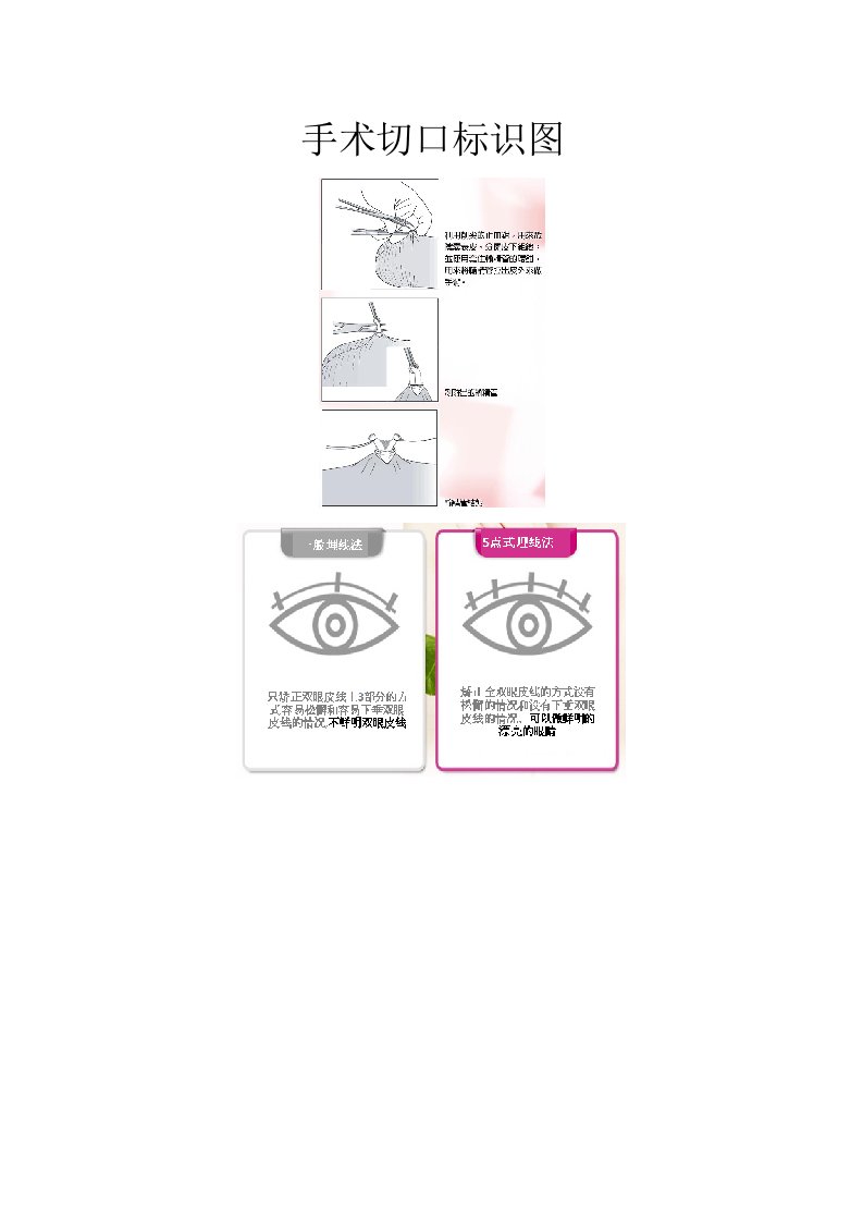 手术切口标识图