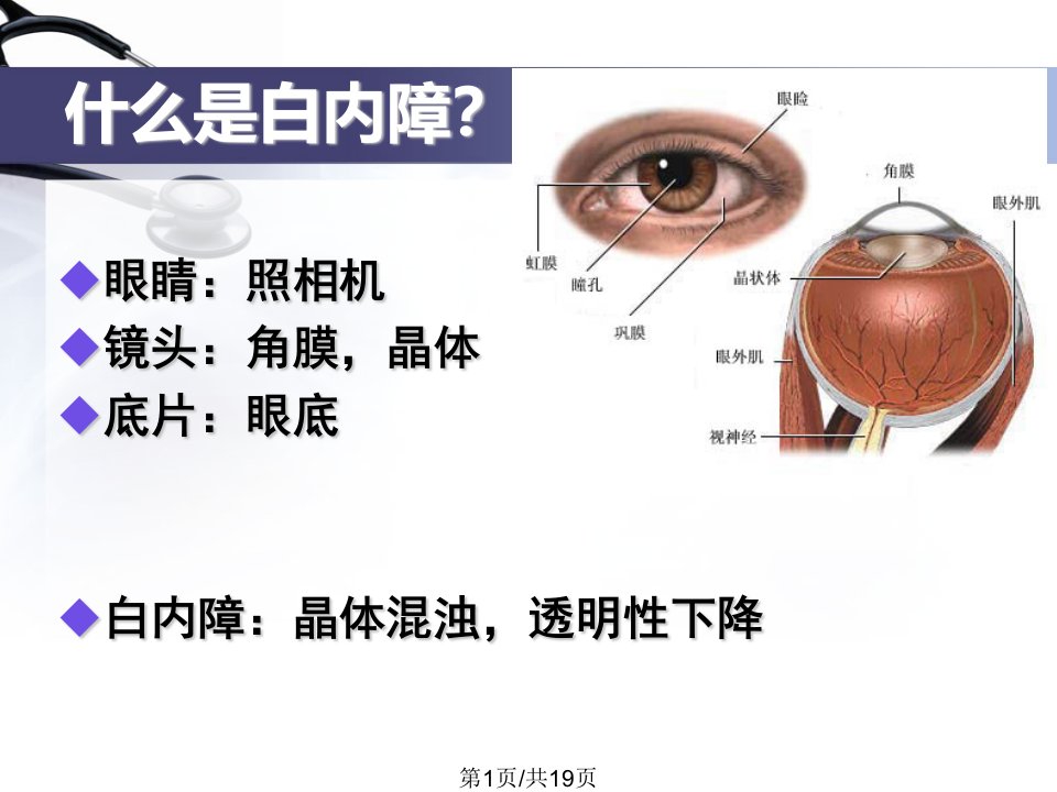 白内障的科普介绍