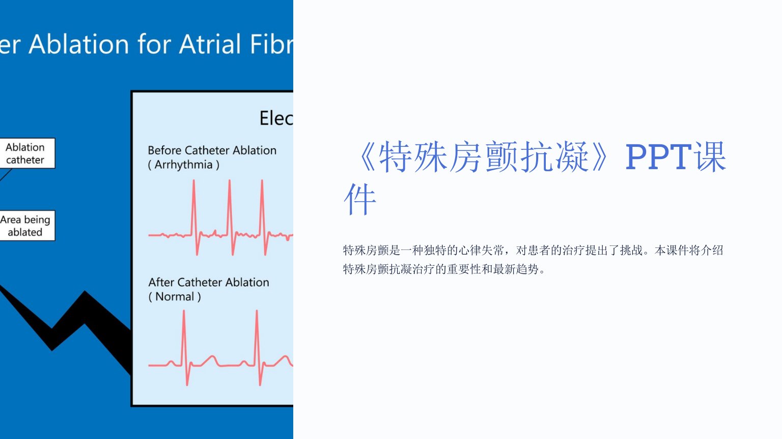 《特殊房颤抗凝》课件