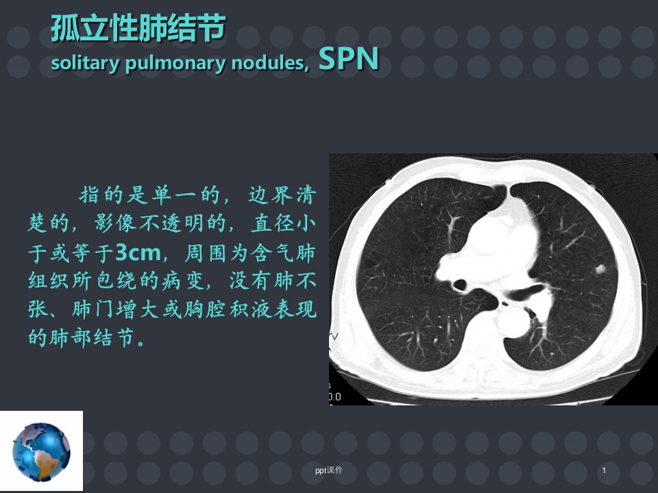 孤立性肺结节的诊断和治疗ppt课件