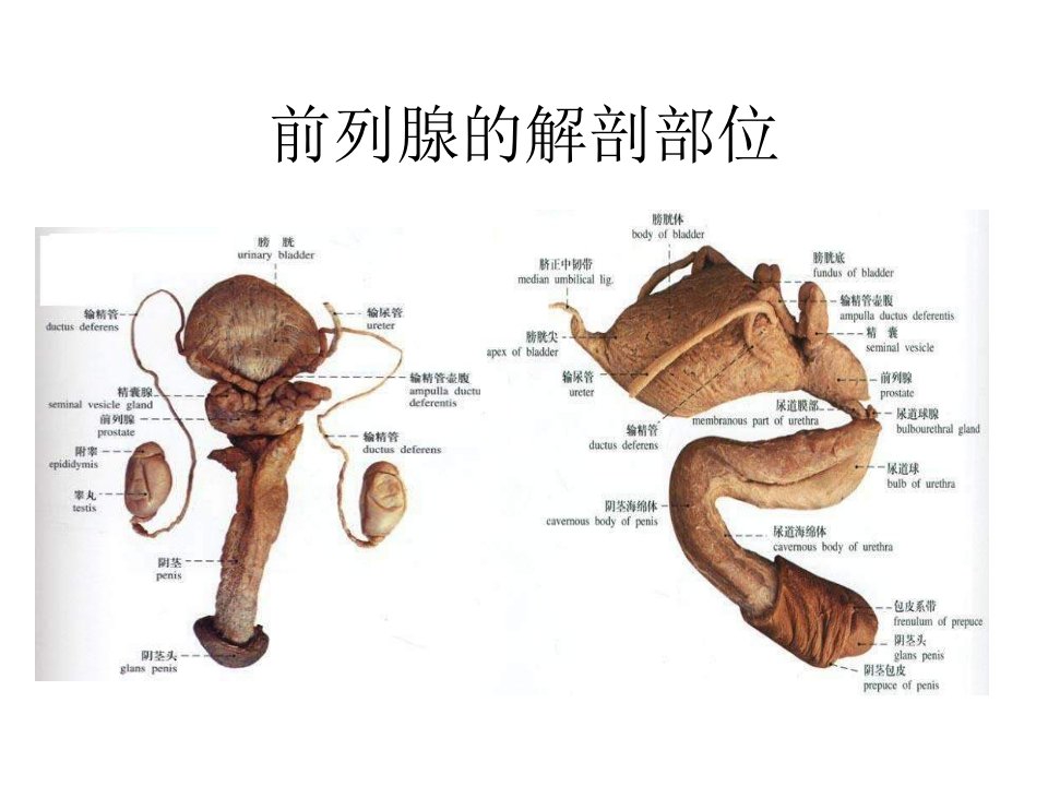 医学专题前列腺增生症