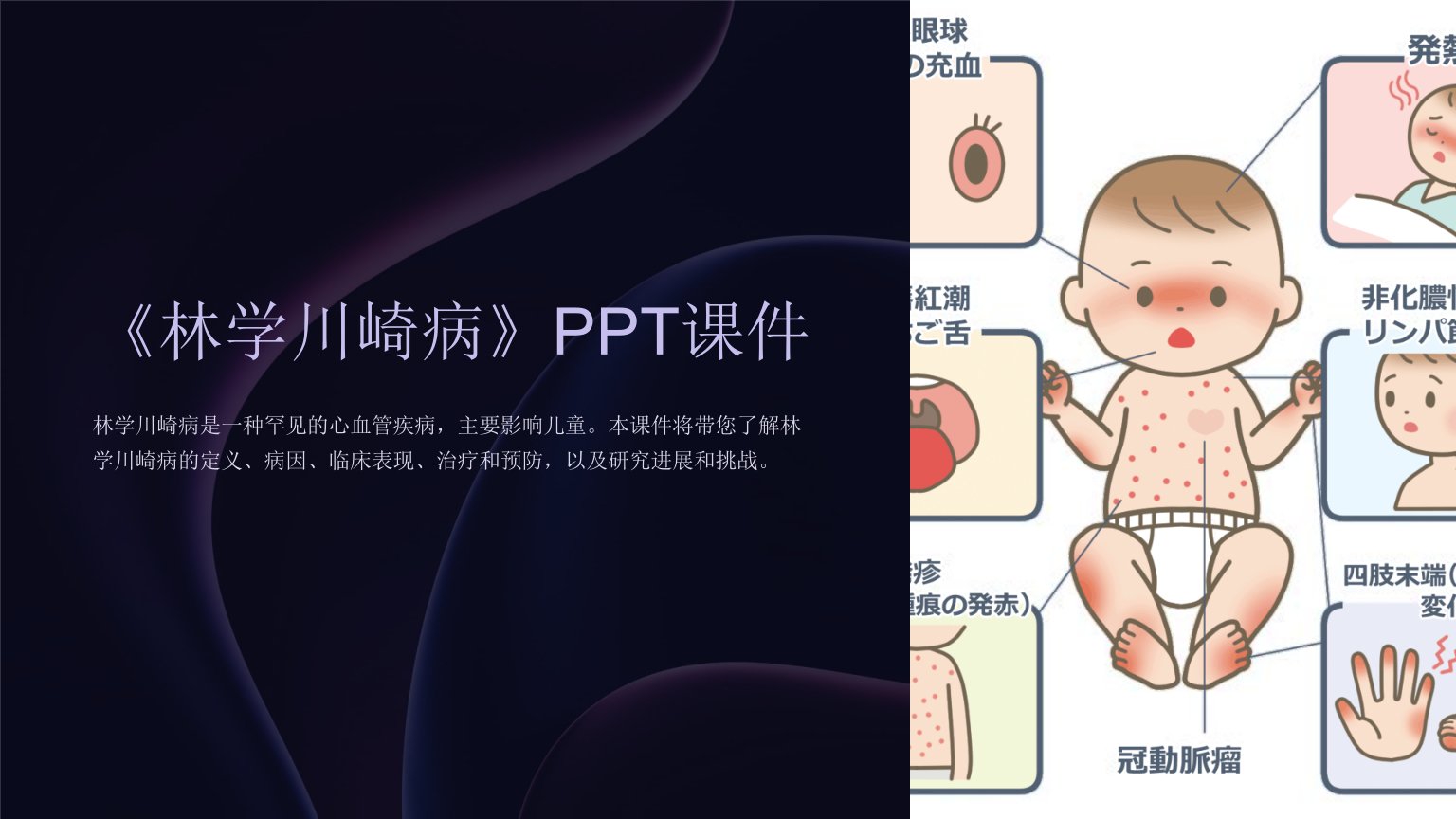 《林学川崎病》课件