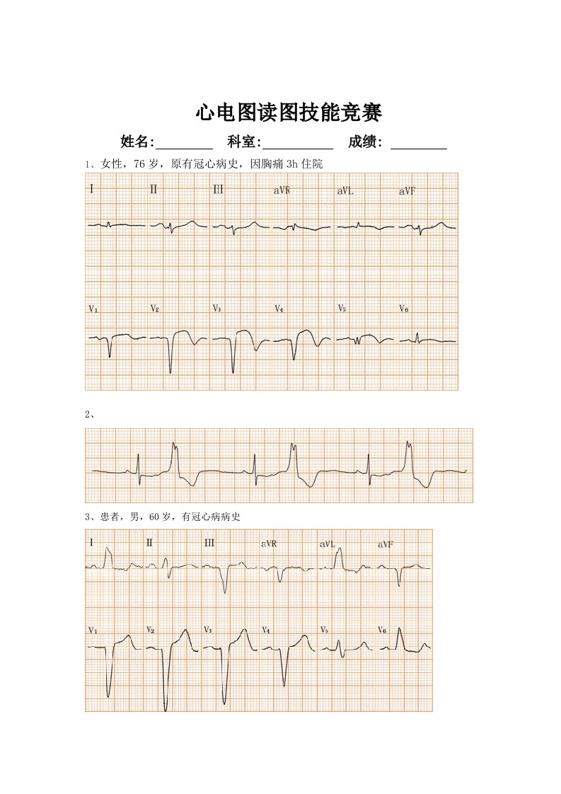心电图读图试题