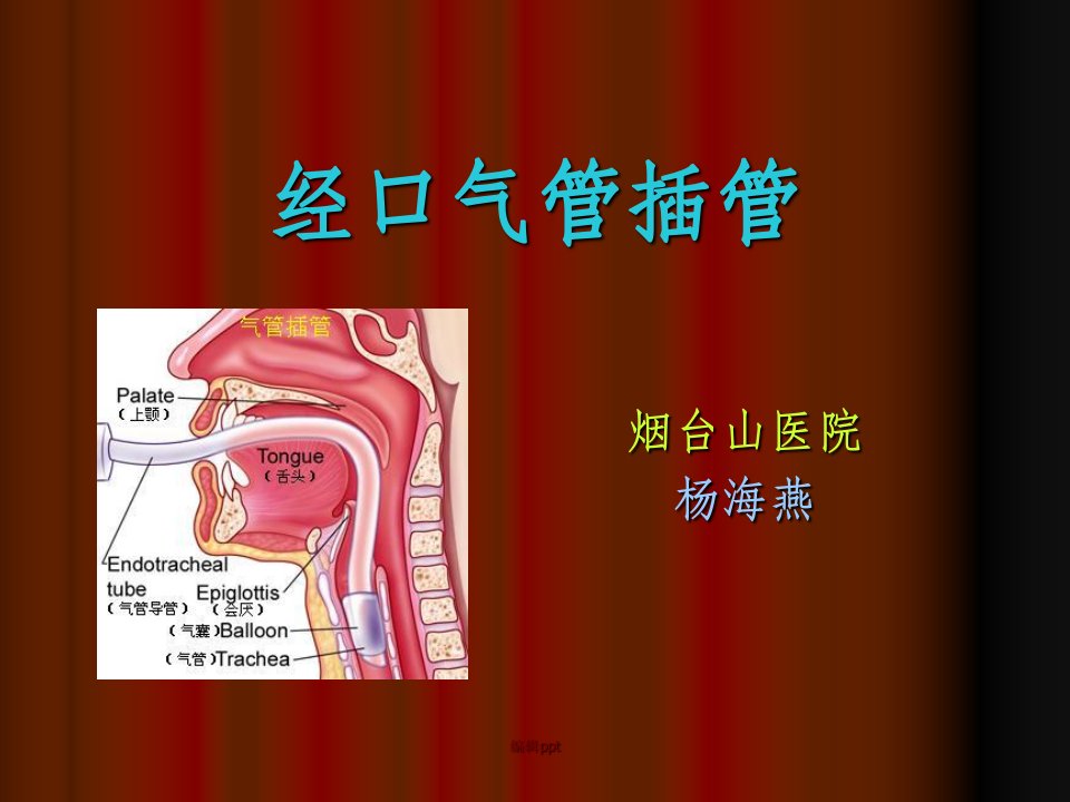 气管插管技术杨海燕