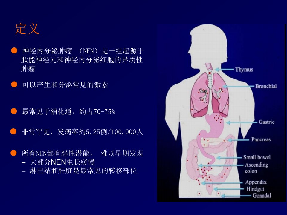 胃肠胰腺神经内分泌肿瘤