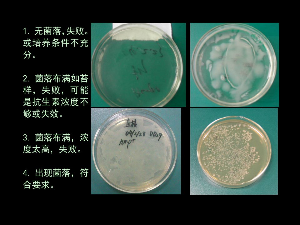 质粒转化大肠杆菌实验