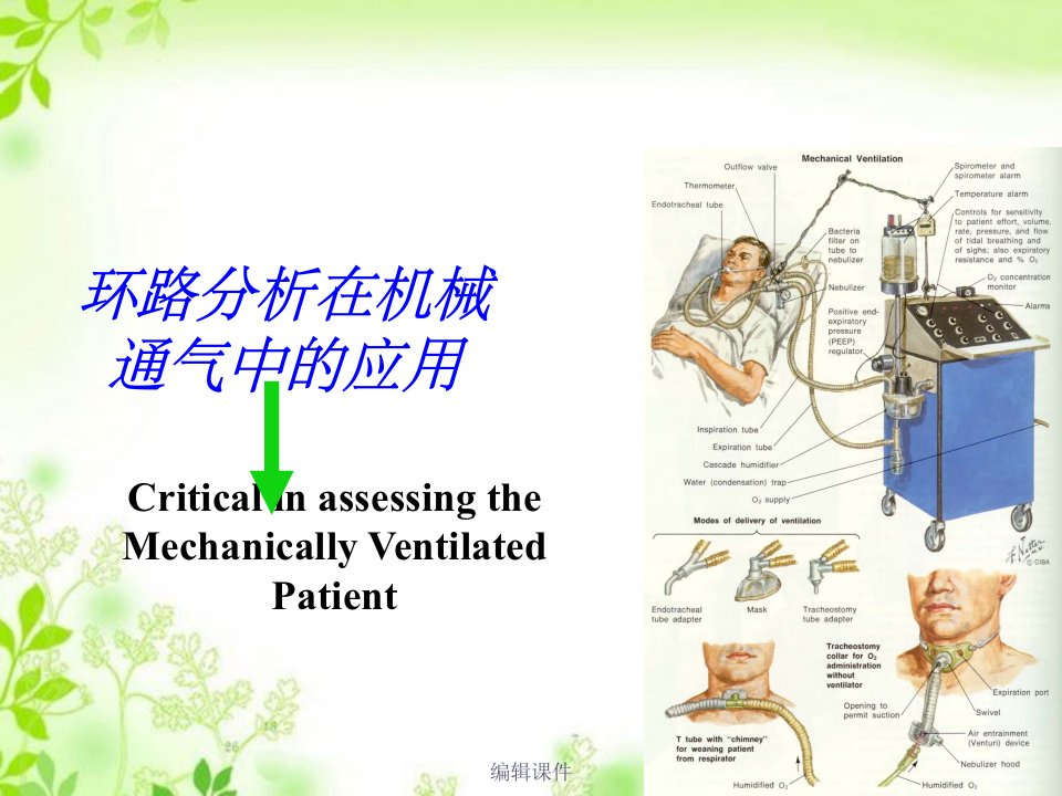 环路分析在机械通气中的应用